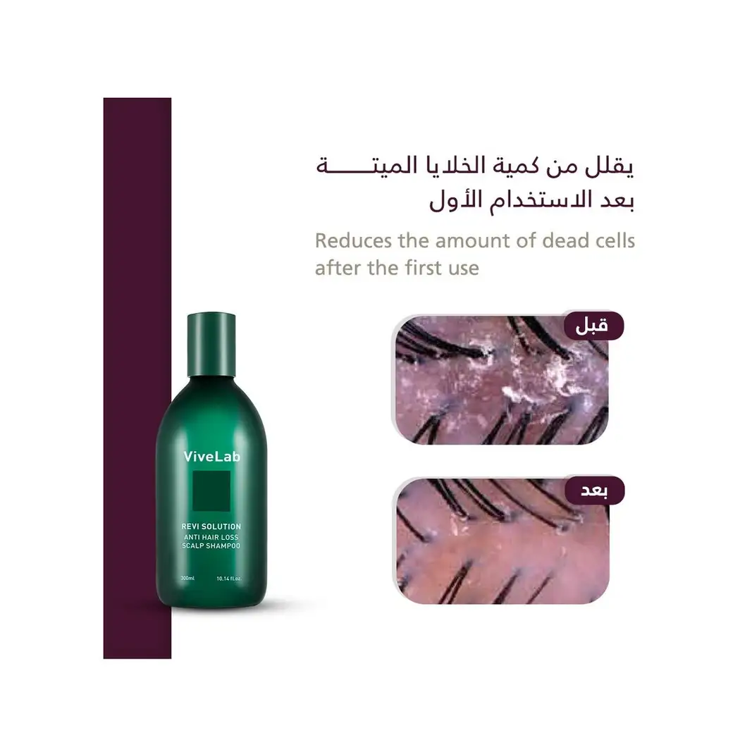 Vivelab: Revive Therapy Hair Scalp & Hair Tonic – 100 mL - 74560